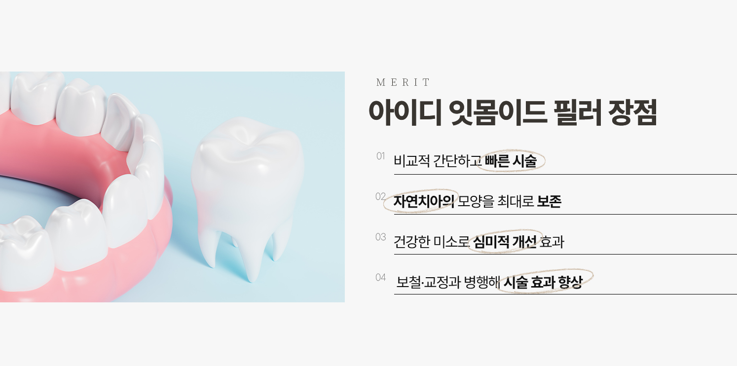 아이디 잇몸이드 필러 장접