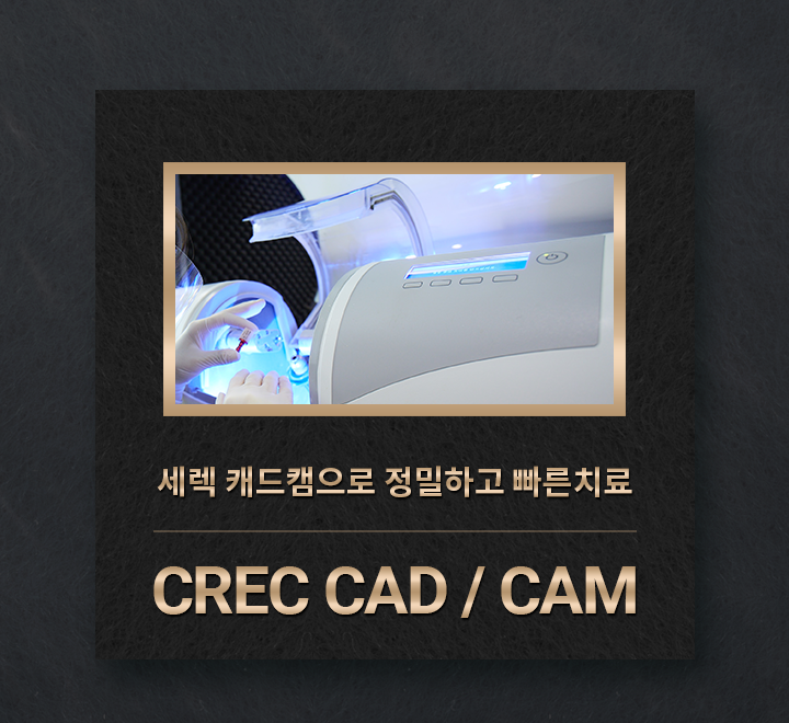 세렉 캐드캠으로 정밀하고 빠른치료. CREC CAD / CAM