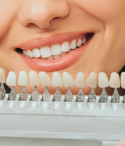 1:1 커스텀 라미네이트