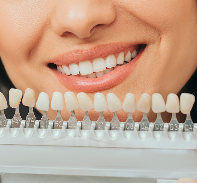 1:1 커스텀 라미네이트